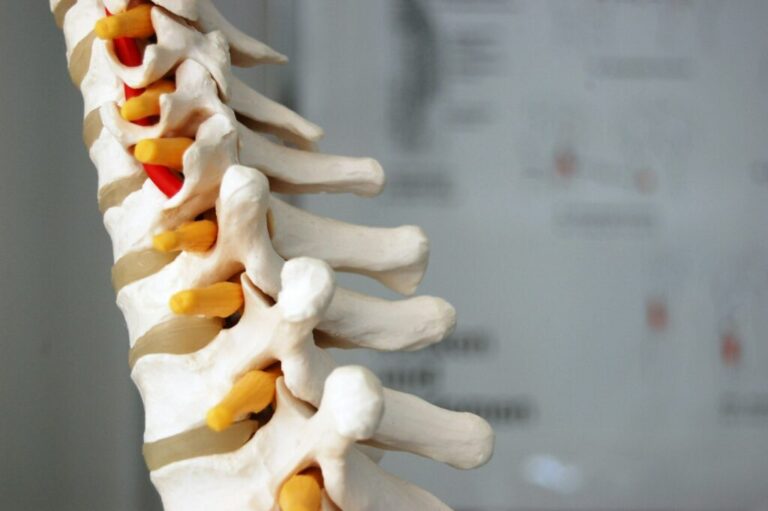 Best spine care treatments in dubai