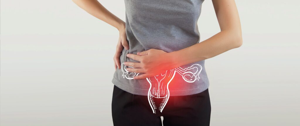 PCOD treatment in dubai