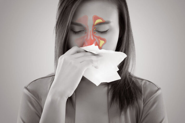 Sinusitis treatment in dubai