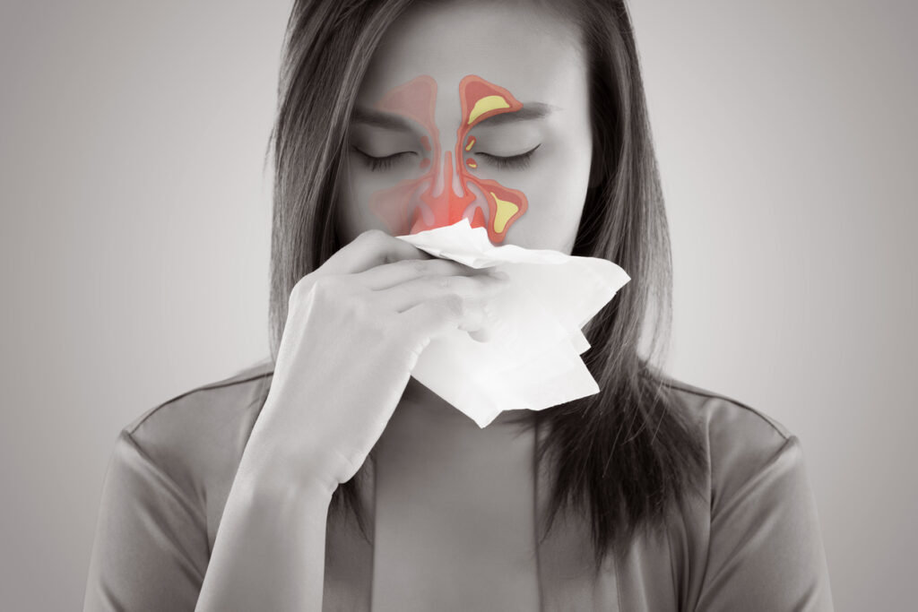Sinusitis treatment in dubai
